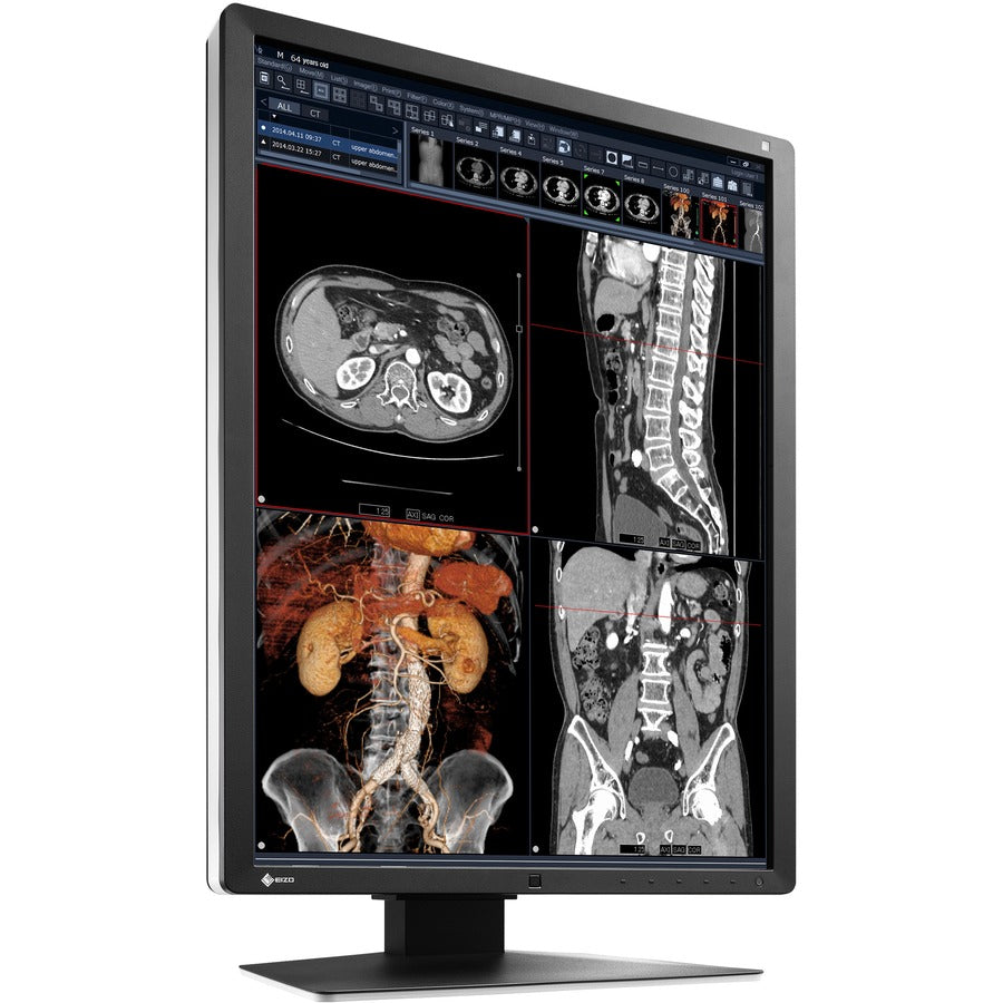 EIZO RadiForce RX250 21.3" LED LCD Monitor - 3:4 - Black